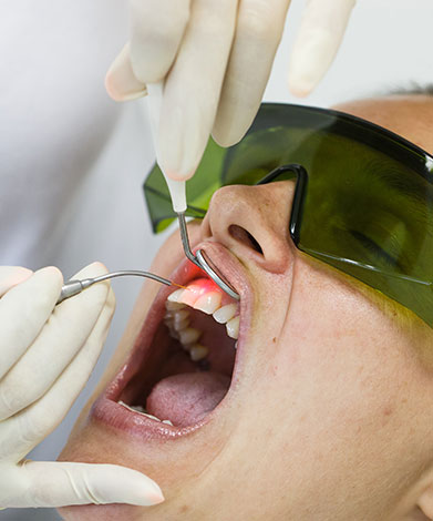 Laser Therapy | Family Dental Centre | General and Family Dentist | SE Calgary