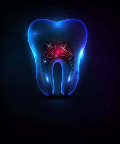 Root Canal Therapy | Family Dental Centre | General and Family Dentist | SE Calgary